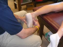 Custom plaster cast orthotic St George UT