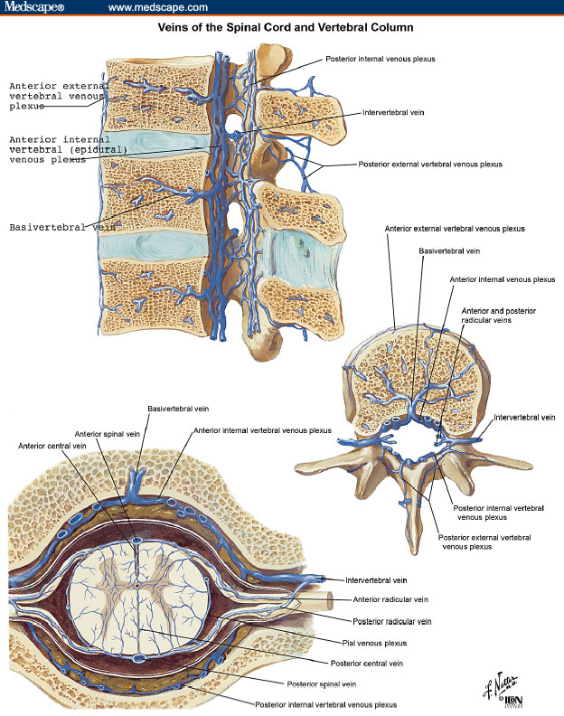 Roadtrip Sciatica treatment -Innova Pain Clinic